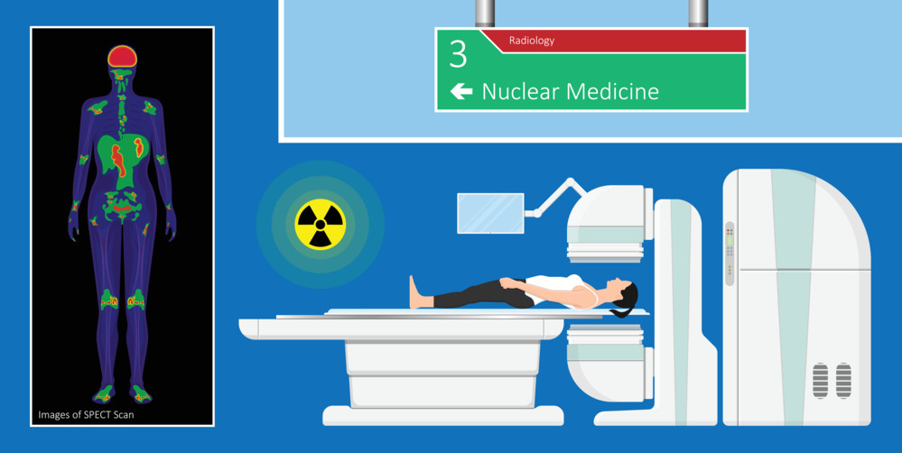 Illustration of Nuclear Imaging machine and SPECT Scan